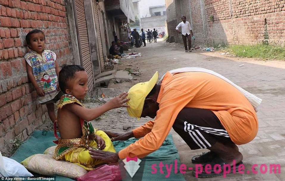 Indiánské vesnice je uctíván chlapce s deformovanou hlavou jako boha Ganesha