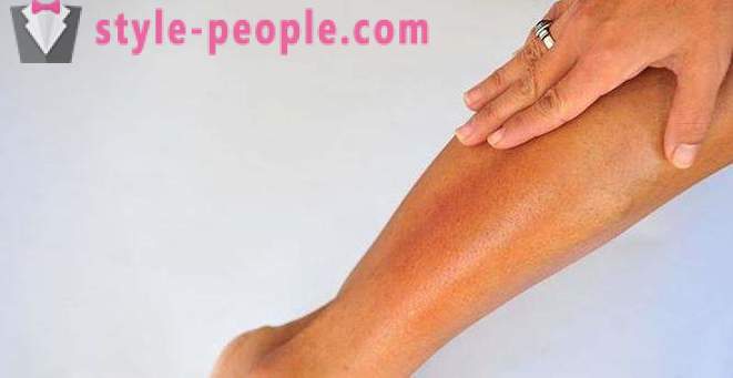 Suchá kůže na nohou: Příčiny
